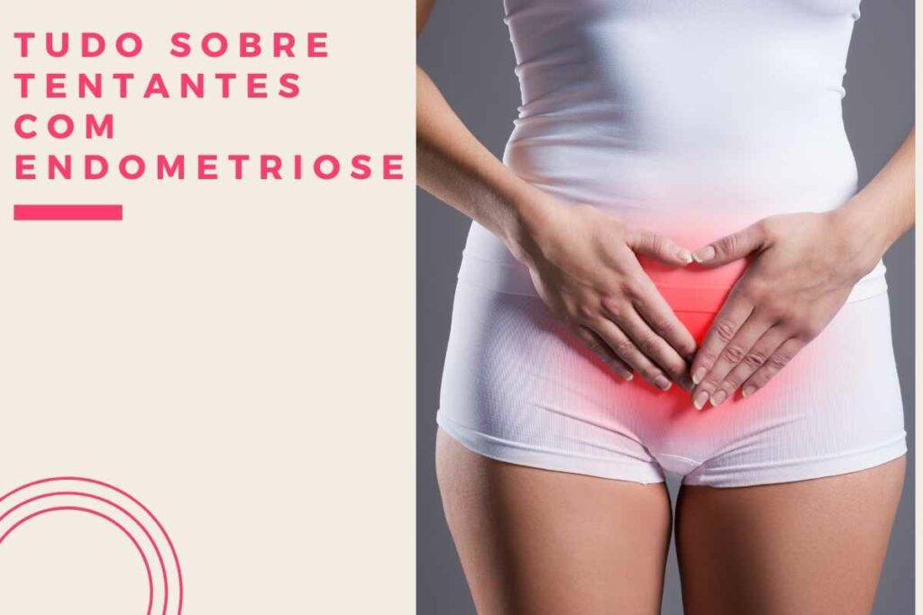 Tudo sobre tentantes com Endometriose (1)