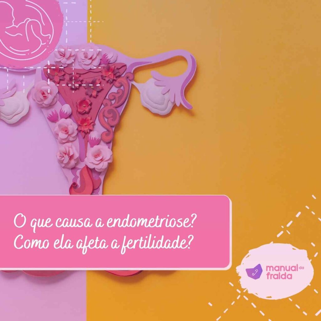 O que causa a endometriose Como ela afeta a fertilidade