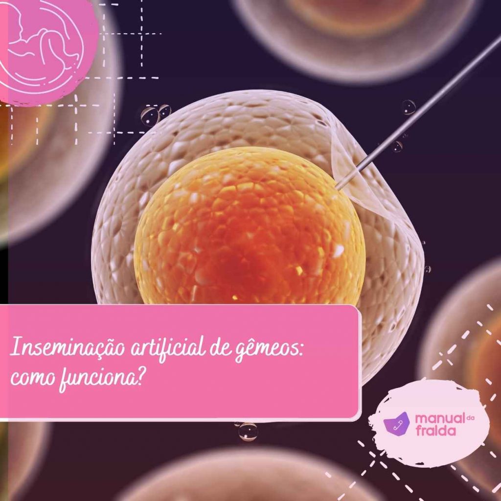 Inseminação artificial de gêmeos: como funciona?