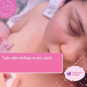 Tudo sobre inchaço no pós-parto