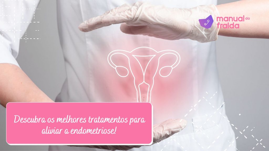 Descubra os melhores tratamentos para aliviar a endometriose!