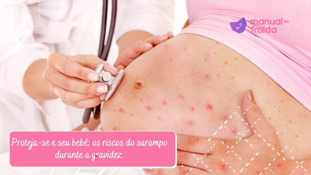 Proteja-se e seu bebê: os riscos do sarampo durante a gravidez.